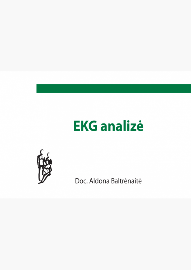 EKG analizė
