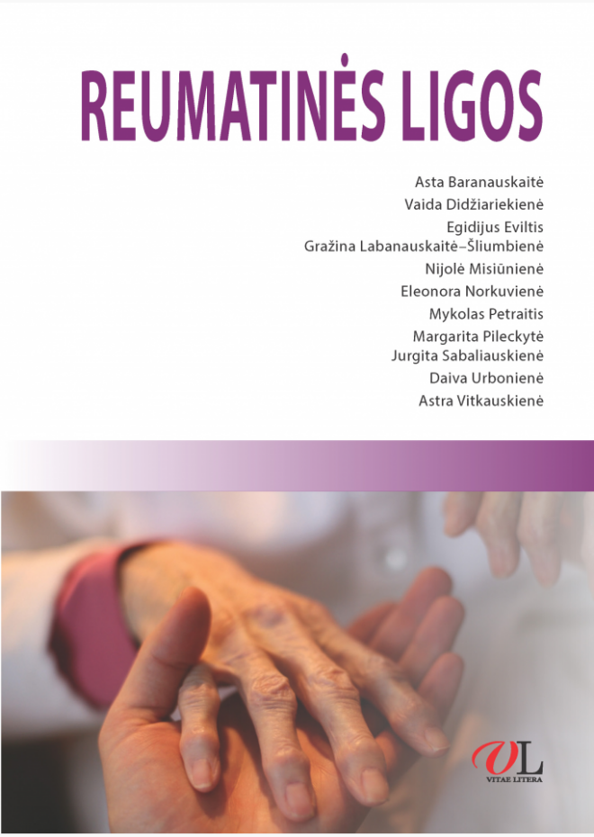 Reumatinės ligos