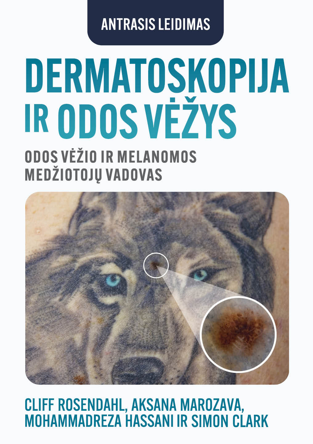 DERMATOSKOPIJA IR ODOS VĖŽYS